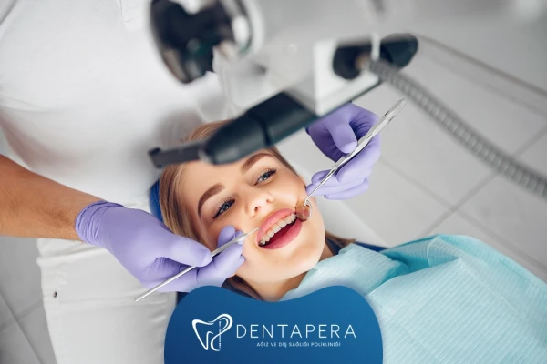 Diş Teli Fiyatları Ne Kadar? Tedavi Maliyetini Neler Etkiler? | Denta Pera