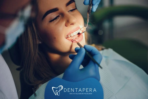 Diş Teli Tedavisi Nasıl Yapılır? | Denta Pera